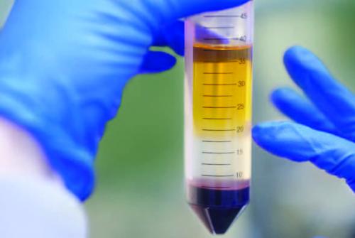 Testing a sample of urine